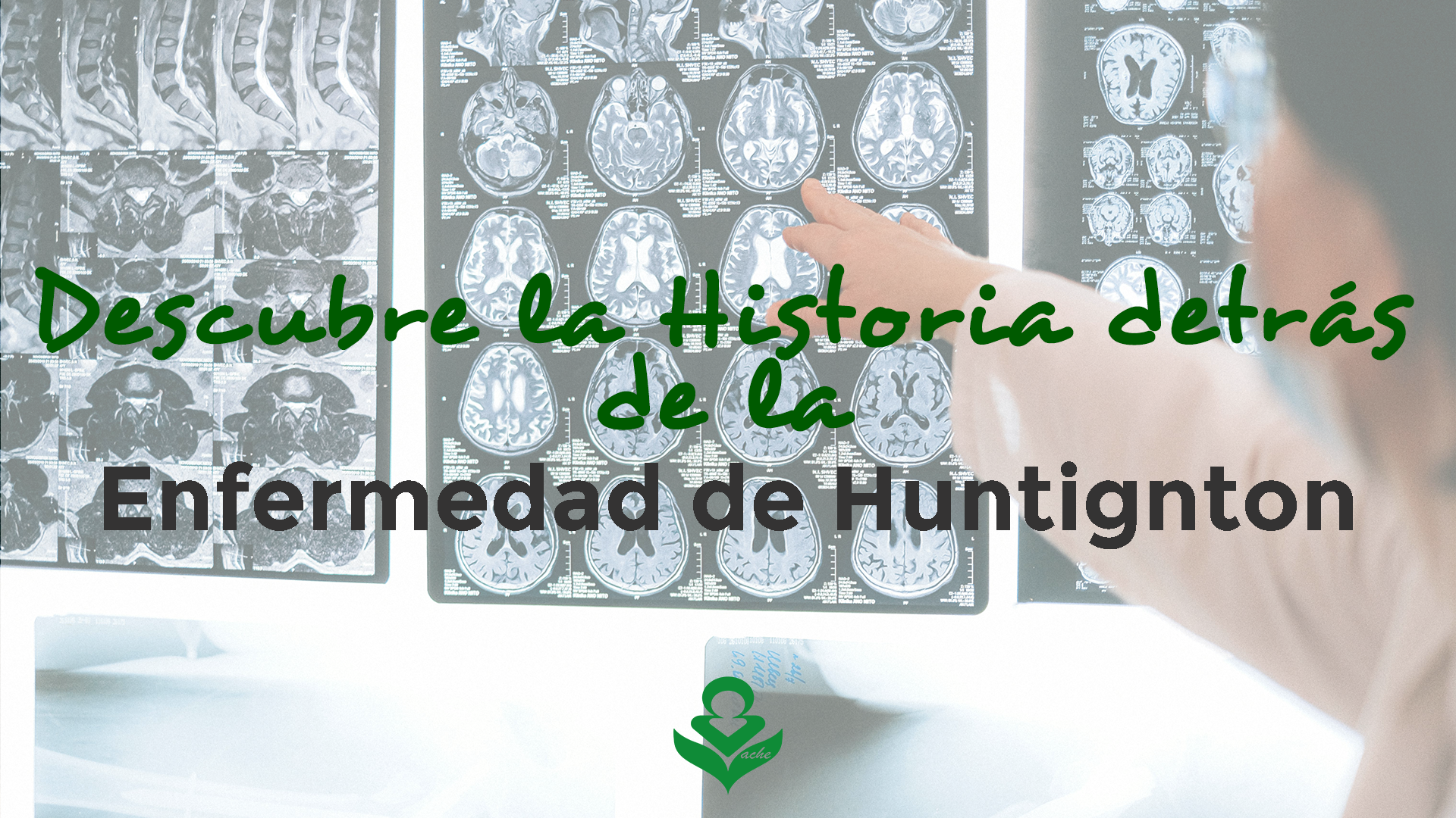 Lee más sobre el artículo ¡Descubre la historia detrás de la Enfermedad de Huntington!